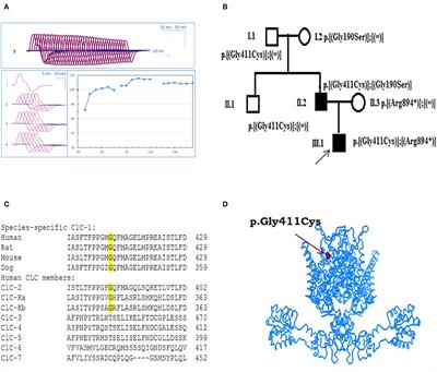 Pathomechanisms of a CLCN1 Mutation Found in a Russian Family Suffering From Becker's Myotonia